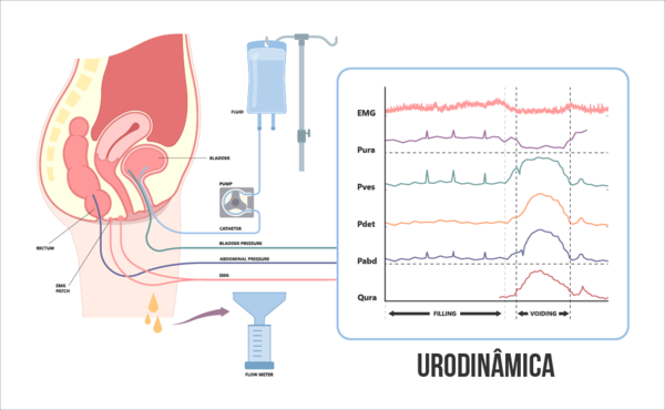 urodinâmica completa